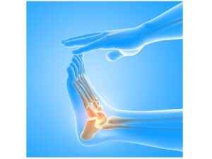 plantar fasciitis treatment in Hyderabad