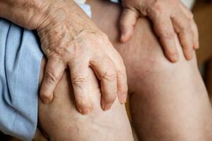 Care after knee replacement surgery