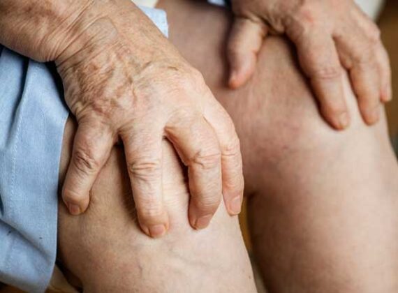 Care after knee replacement surgery