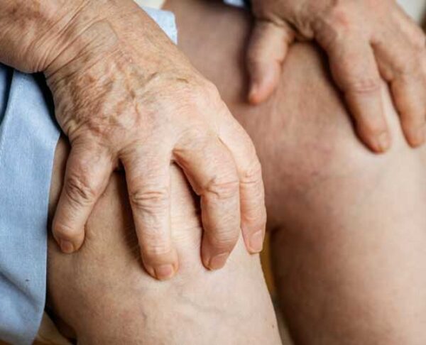 Care after knee replacement surgery