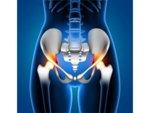 hip pain causes