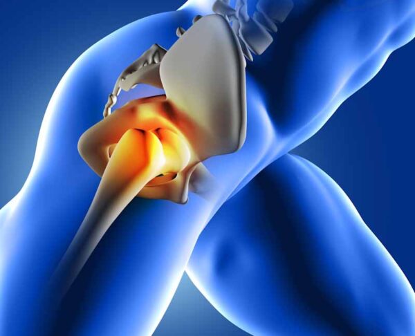 Hip fracture treatment in Hyderabad