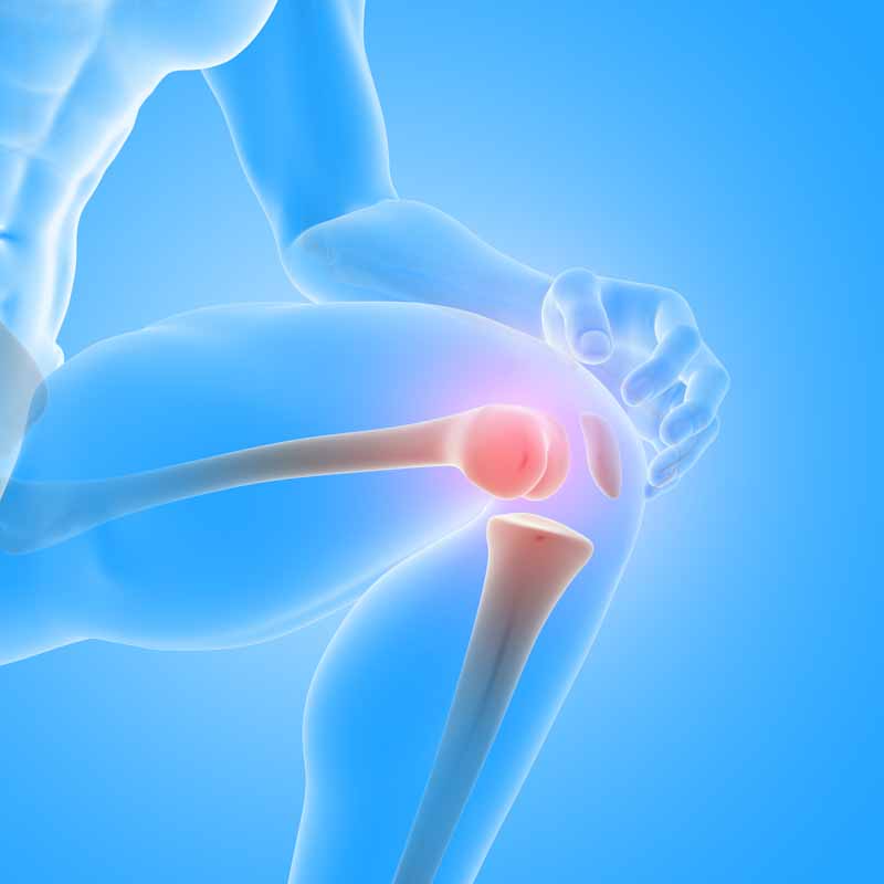 Care After Knee Replacement: